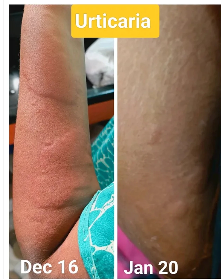 Skin Condition Treatment Results